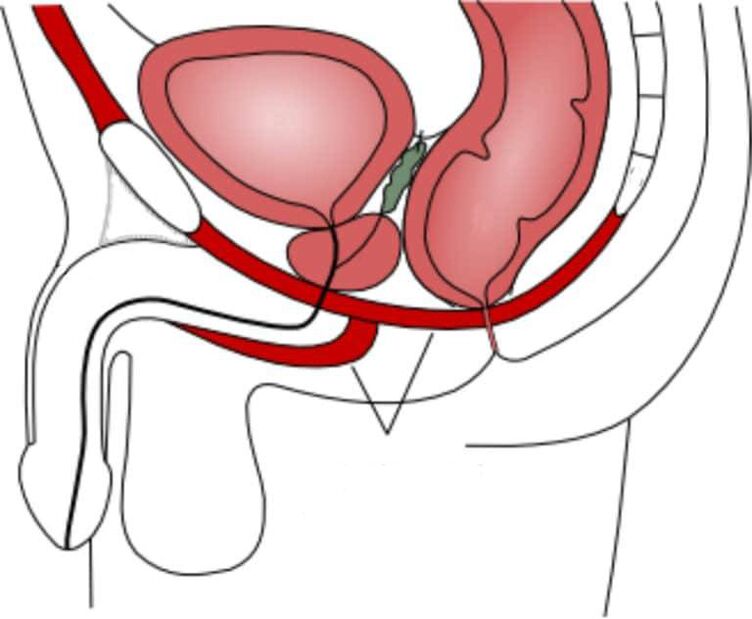 latihan otot lanté pelvic pikeun ngaronjatkeun potency